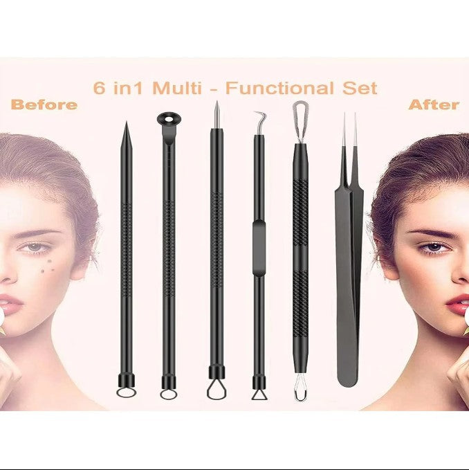 6pcs/Set Acne Removal Needle and Clip Stainless Steel Tool Blackhead Removal